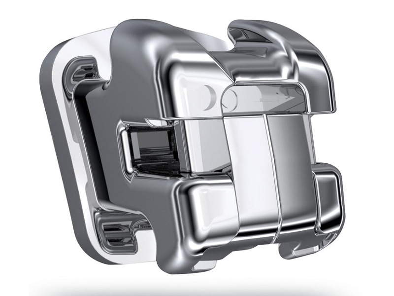 Брекеты Ormco Damon: Инновационная система для красивой улыбки