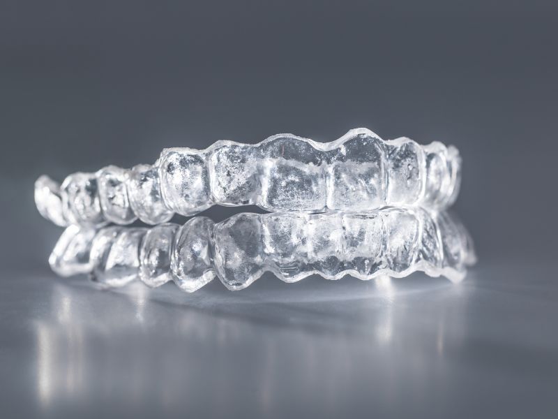 Исправление прикуса с помощью кап: как элайнеры меняют вашу улыбку