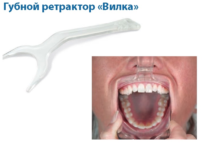 00000014274