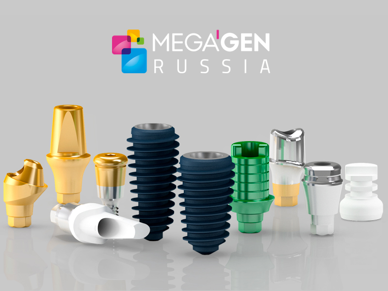 AnyRidge — имплантационная система, которая выбирает будущее стоматологии