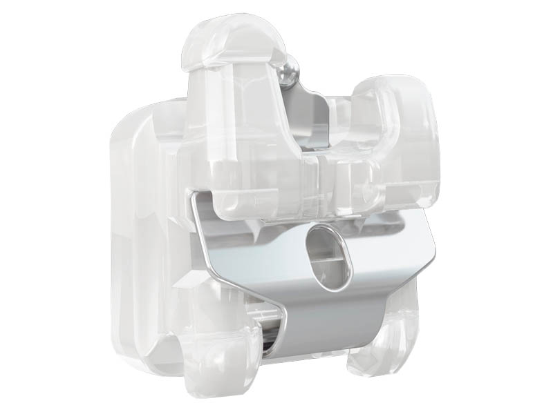 Самолигирующиеся эстетические брекеты: почему стоматологическим клиникам стоит перейти на эту технологию