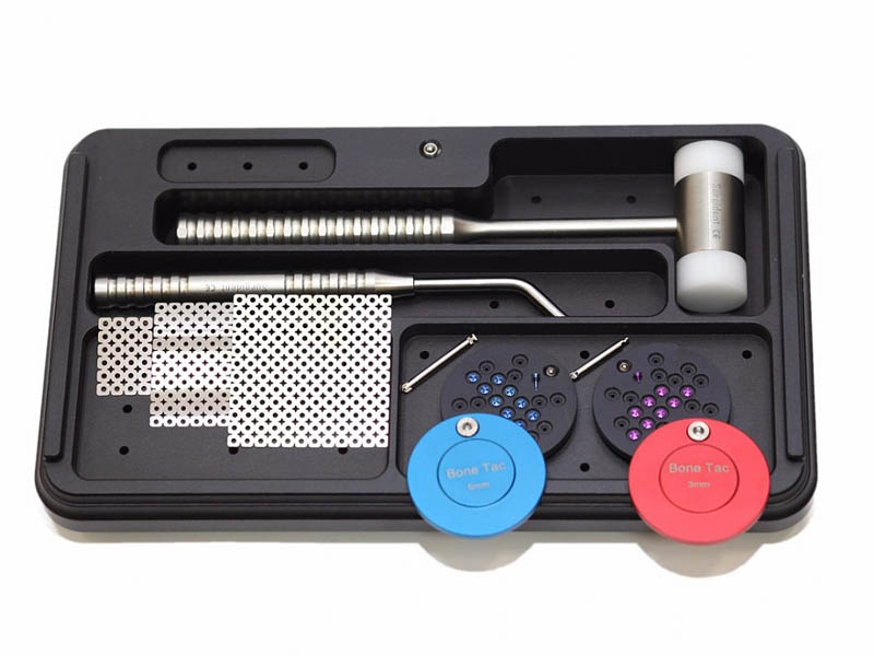 Виды имплантационных систем: как выбрать надёжное решение для практики