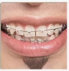 00000007736