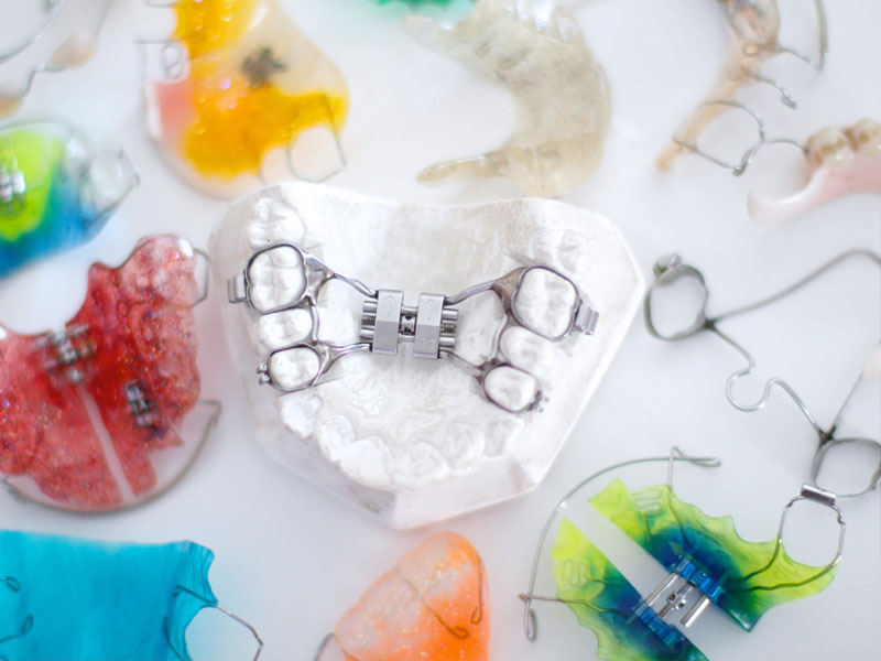 Ортодонтические аппараты в зависимости от принципа их работы