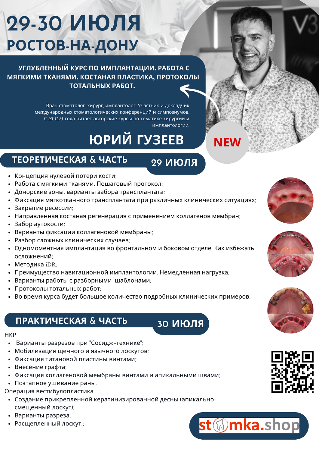 Углубленный курс по имплантации. Работа с мягкими тканями,костная пластика, протоколы тотальных работ.